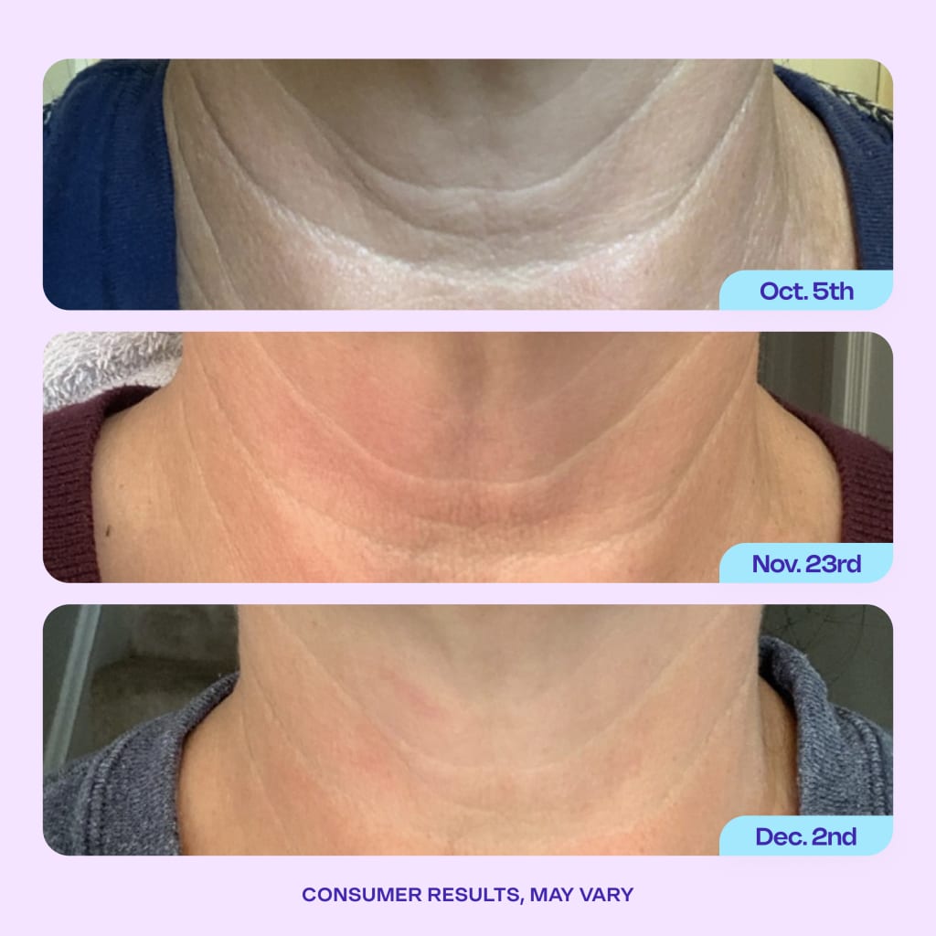 Neck Lift & Firming Cream